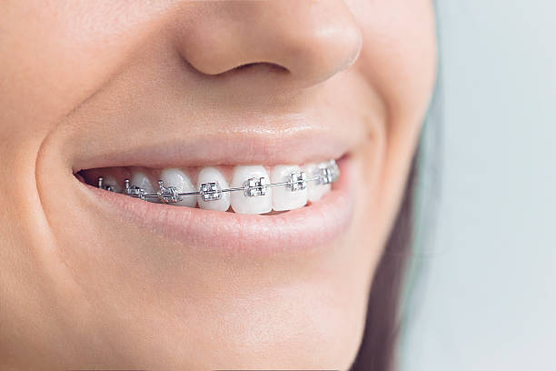 Best Tooth Extraction  in Aberdeen, NC